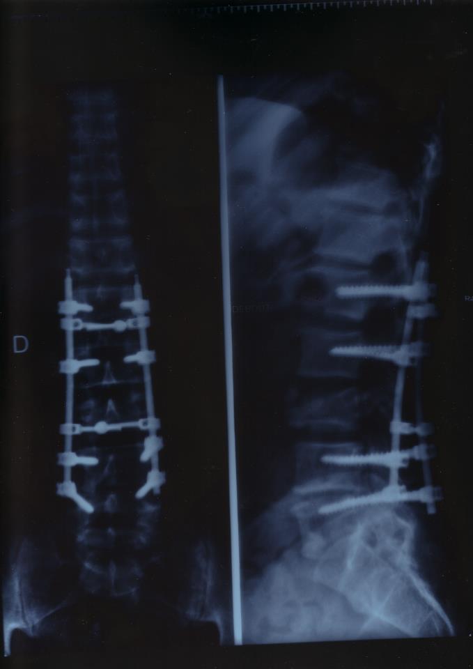 Chablis........man !