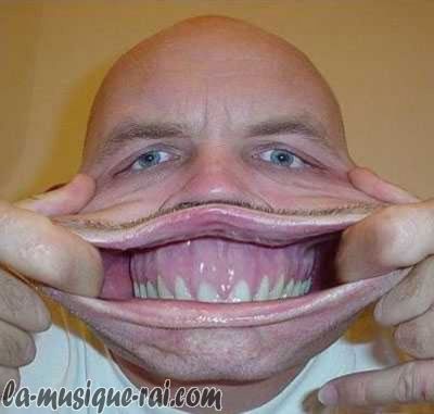 Image attachée